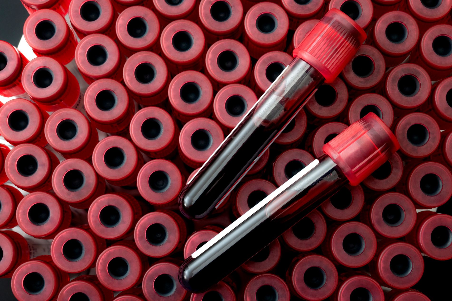 Phlebotomy, biochemical analysis, laboratory exam and blood testing concept theme with two test tubes on blood collection test tube set with copyspace